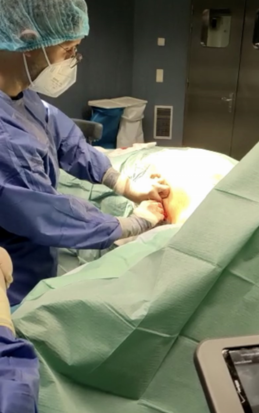 CHMT implanta pela primeira vez cardioversor-desfibrilhador subcutâneo